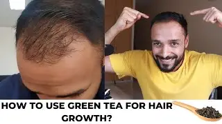 Benefits of GREEN TEA for HAIR LOSS and how to USE it for BEST RESULTS?