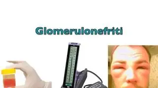 Rene: funzioni e disfunzioni. Come si previene SIN FIR.
