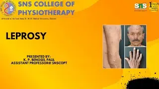 Leprosy- Community medicine- SNS institutions