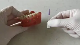 Interdental Cleaning