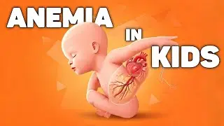 Iron Deficiency Anemia in Kids | Symptoms, Treatment & Iron-Rich Foods | Dr. Hina Baig
