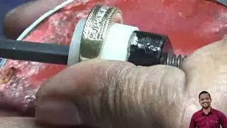 micro Setting मे चानेल सेटिंग कैसे करते हे...💎💍🔬