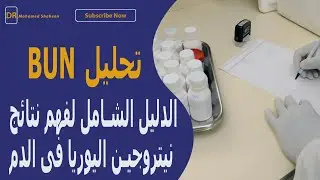تحليل BUN - الدليل الشامل لفهم نتائج نيتروجين اليوريا في الدم!