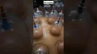 DRY CUPPING THERAPY FOR BACK PAIN| DRY CUPPING ||\ BACKPAIN| CUPMASSAGE| MUSCLEGROWTH| BODYRECOVERY|