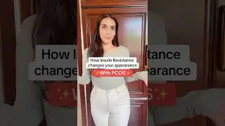 How Insulin Resistance changes your appearance with #pcos