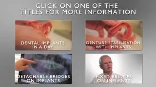 Elmsleigh House Implant Clinic can place dental implants in a day.mov