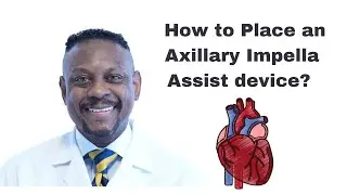 How to Place an Impella Left Ventricular Device through the Axillary artery