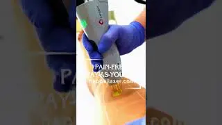 Smooth Skin Starts Here in Pittsburgh! | Laser Hair Removal at Happel Medical Spa