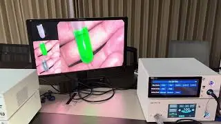 Camjoy 4K ICG Endoscope Camera