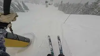 Sierra Liftline Top 2 Bottom