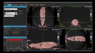 Intuitive Advanced Radiation Planning for SARRP using SmART-XPS