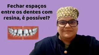 Fechar espaço entre os dentes com resina é possível? Dra Bianca Rosa
