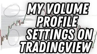 My Volume Profile Settings and Hacks for TradingView