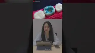 Proses penambalan gigi berlubang yang tidak membutuhkan Perawatan Saluran Akar (PSA) #tambalgigi