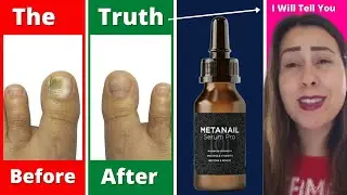 Metanail Complex Review | Metanail Complex Supplement | Metanail Serum Pro Reviews #MetanailComplex