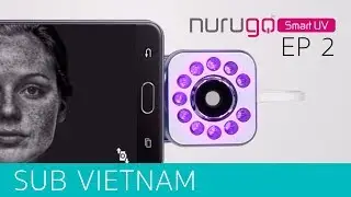 Chemico Plus TV l Nurugo smartUV EP2 (Sub Vietnam)