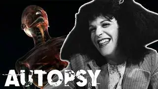 Gilda Radner: A Comedic Light Dimmed Too Soon (4K Documentary) | Our Histroy