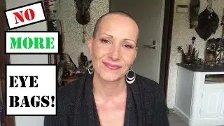 EYE BAGS - How to get rid of them! | No surgery! | Cheap &  Easy!