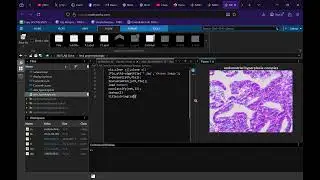 🧠 CNN Transfer Learning in MATLAB | Classification of Endometrial Diseases (Cancer, Polyps & More)