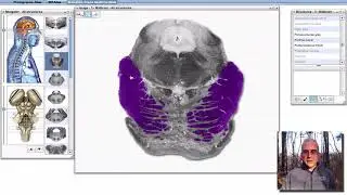 Internal Anatomy of the Brainstem