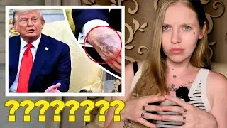 What&rsquo;s That in His Hand? Is Trump DEAD? The Viral Theory Breaking the Internet
