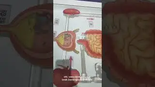 Thrombosis #robot #machine #exhibitions #sciencecenter #innovation #toy #exhibitdesigner #science