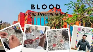 &ldquo;Blood Group Determination | Easy Lab Practical | ABO & Rh Factor Explained&rdquo; #ytvideo #youtube 