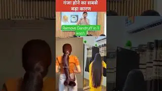 Vedant Sir DIY Dandruff Care' 🌿 | Long & Healthy Hair Growth Home Remedy!#shorts #ytshorts #facts#yt