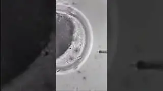Medical Nanobot in Action