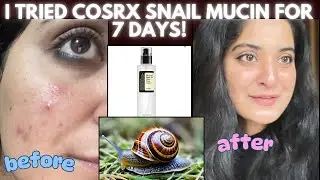 I tried COSRX Snail🐌 mucin essence for 7days and this happened !😳 #cosrx #skincare