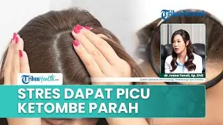 Bukan Cuma Soal Shampo, Pria hingga Orang Mudah Stres Rentan Ketombe, Ini Kelompok yang Berisiko