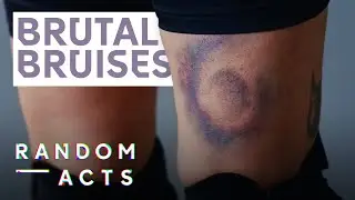 Brutal Bruises from Roller Derby | Derby Kiss by Fanny Hoetzeneder | Doc Film | Random Acts