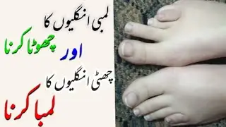 Shortening Long Toes || Lengthening Short toes|| Brachymetatarsia / Before surgery planning