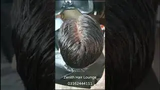 Skin Base  Hair Patch Available at Zenith Hair Lounge