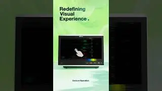 【Preview 1】EDAN iX Series Patient Monitoring Launch