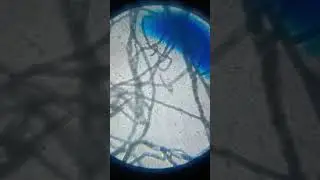 Fungus ( Fungi ) under a microscope. #science #microscope #small #world is looking like hairs .