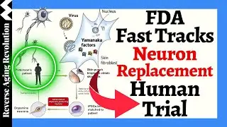 FDA Fast Tracks CELLULAR Reprogramming NEURON Replacement HUMAN CLINICAL TRIAL