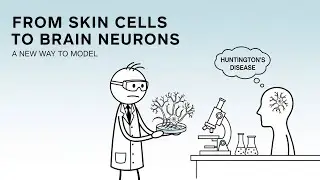 From Skin Cells to Brain Neurons, How Your Skin Could Hold the Key to Treating Huntington&rsquo;s Disease