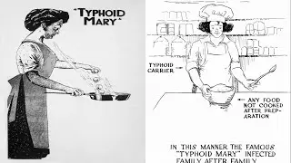 Who was Typhoid Mary || Story of Mary Mallon: An Enigmatic Typhoid Carrier
