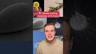 Top 5 Most Deadly Diseases ☠️
