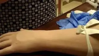 IV start video