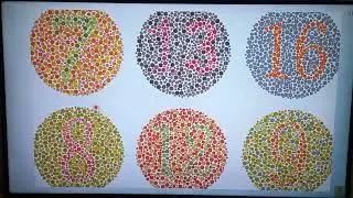 Properties Of Light And Visual Function.By (Dr Laiba Asif)PGR-1 MEHT