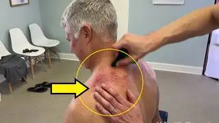 DARK PURPLE GUNK In Skin 🥴 Strong Man Gets *CRACKED* GUA SHA, AND Massaged To Help His RUSTY Joints