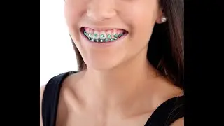 Do You Need Orthodontics? Icon Dental Center Can Help