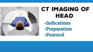CT Imaging of Head | CT head indications  | CT head preparation | CT head protocol | CT head uses