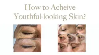 Are you tired of dealing with wrinkles, skin pigmentation, and other irregularities?