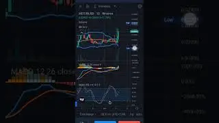 MDT 25% UPSIDE