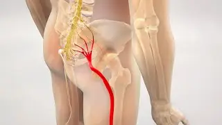 3 Days Treatment for Sciatica Pain | Fast Relief Without Medicine #acupressure #acupuncture #cupping
