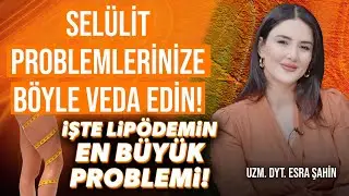 Saç Dökülmesi Sorunu Yaşayanların DİKKATİNE Selülit Probleminize Böyle Veda Edin O Kanserinin Nedeni