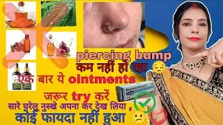  कोई घरेलू नुस्खा नहीं Nose piercing bump सिर्फ 15 दिनों में ही खत्म हो जाएगा सिर्फ इस एक क्रीम से👍🤫